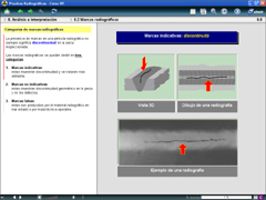 RT - Radiographic marks